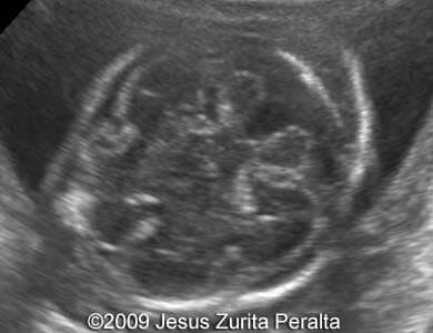 Case259_Peralta_1