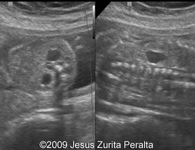 Case259_Peralta_10