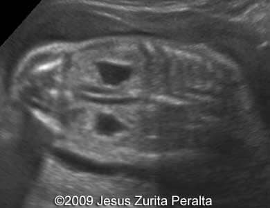 Case259_Peralta_11