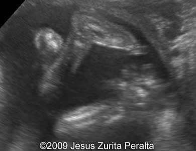 Case259_Peralta_12