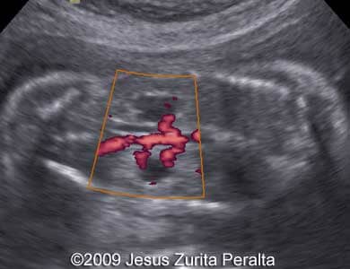 Case259_Peralta_13