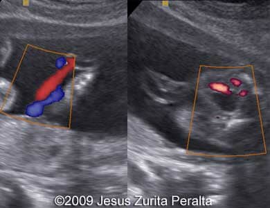 Case259_Peralta_14