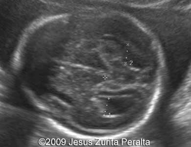 Case259_Peralta_2