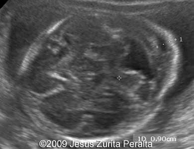 Case259_Peralta_3