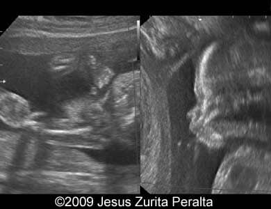 Case259_Peralta_4