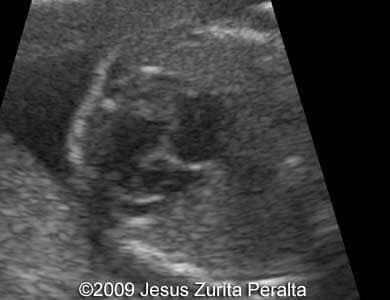 Case259_Peralta_5