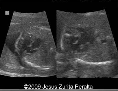 Case259_Peralta_6
