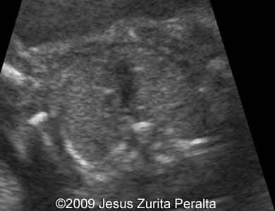 Case259_Peralta_7