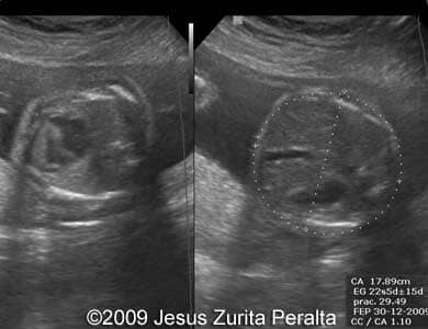 Case259_Peralta_8