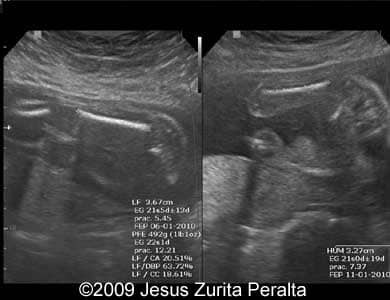 Case259_Peralta_9