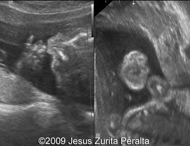 Case259_Peralta