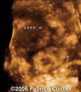 case5b