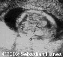case77_2