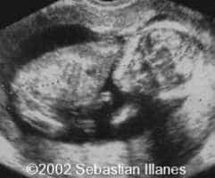 case77_3