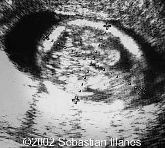 case77_5