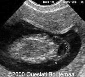 cncoupetangentielle_11sa5j