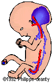 cystic1