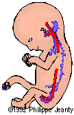 cystic4