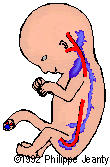 cystic5