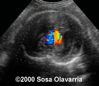 de an500