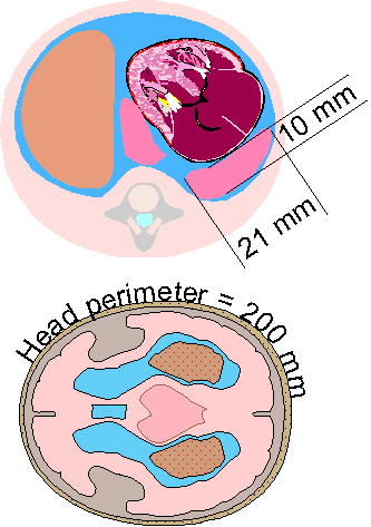 diaphr1