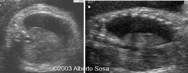 Diapositiva 02