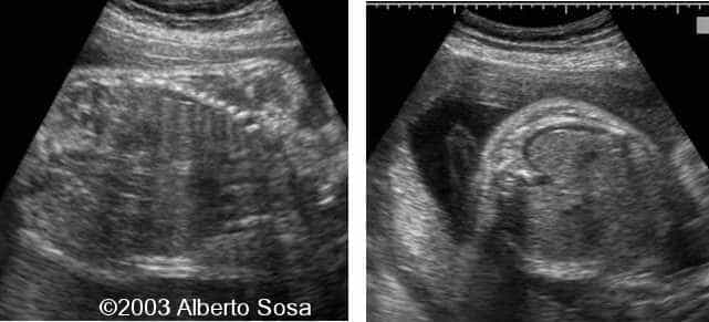 Diapositiva 03
