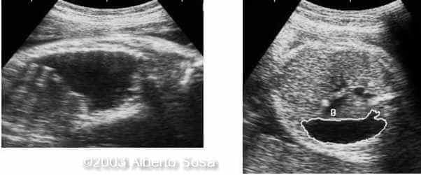 Diapositiva 04