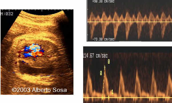 Diapositiva 05