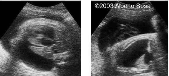 Diapositiva 06