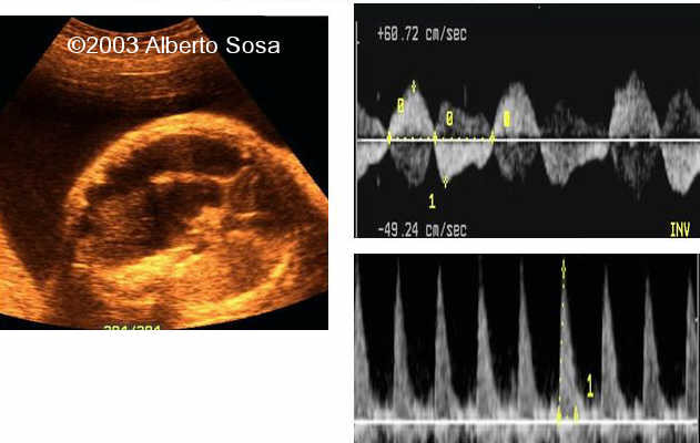 Diapositiva 07