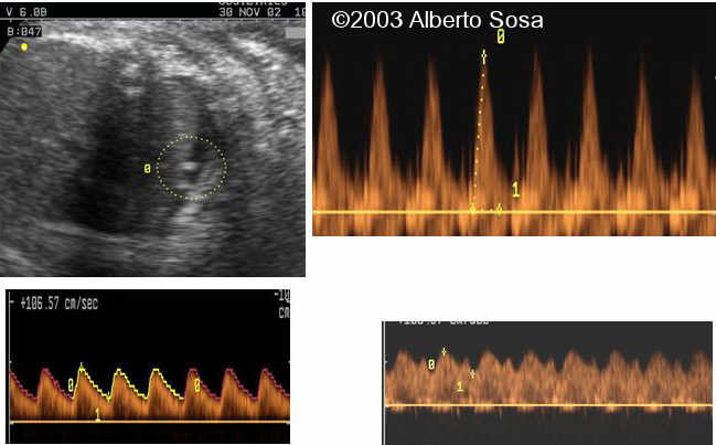 Diapositiva 08