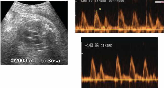 Diapositiva 09