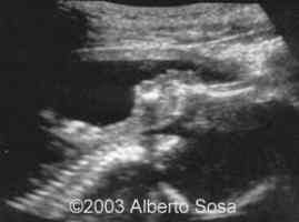 Diapositiva1 copy