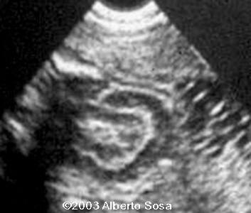 Diapositiva1