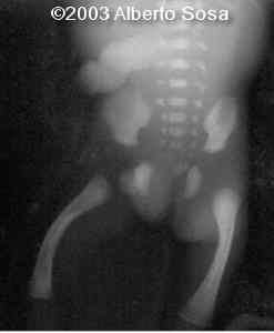 Diapositiva1