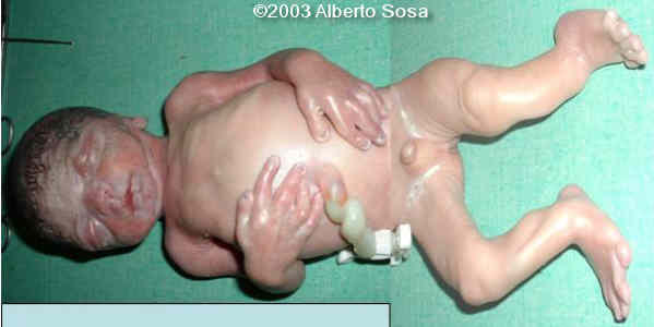 Diapositiva10