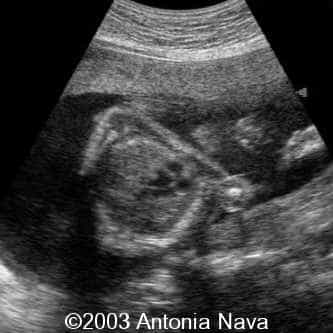 Diapositiva10