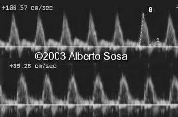Diapositiva10