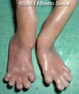 Diapositiva11
