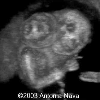 Diapositiva12