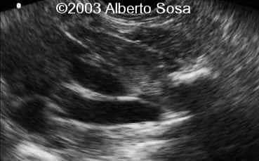Diapositiva13
