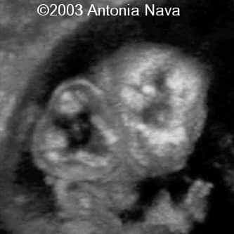 Diapositiva14
