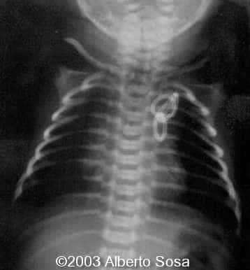 Diapositiva14