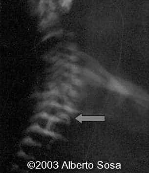 Diapositiva15