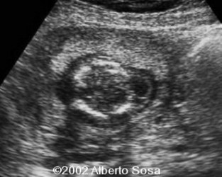 Diapositiva2 (2)