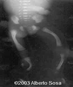 Diapositiva2