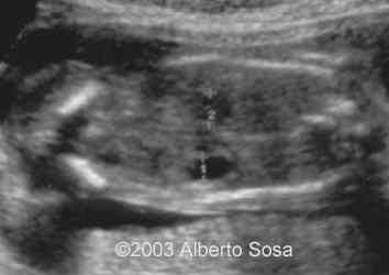 Diapositiva2