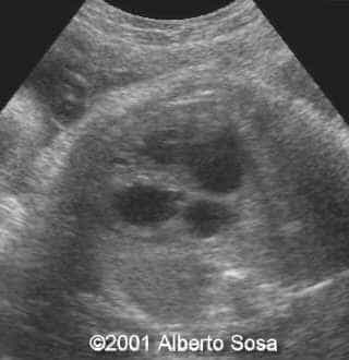 Diapositiva2