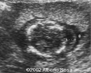 Diapositiva3 (2)